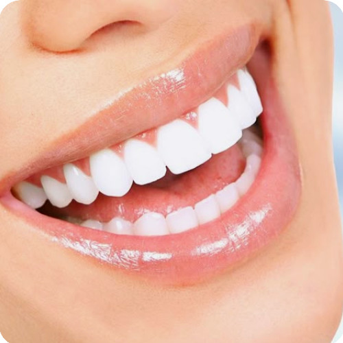 Enamel safe ultimate whitening - safe,